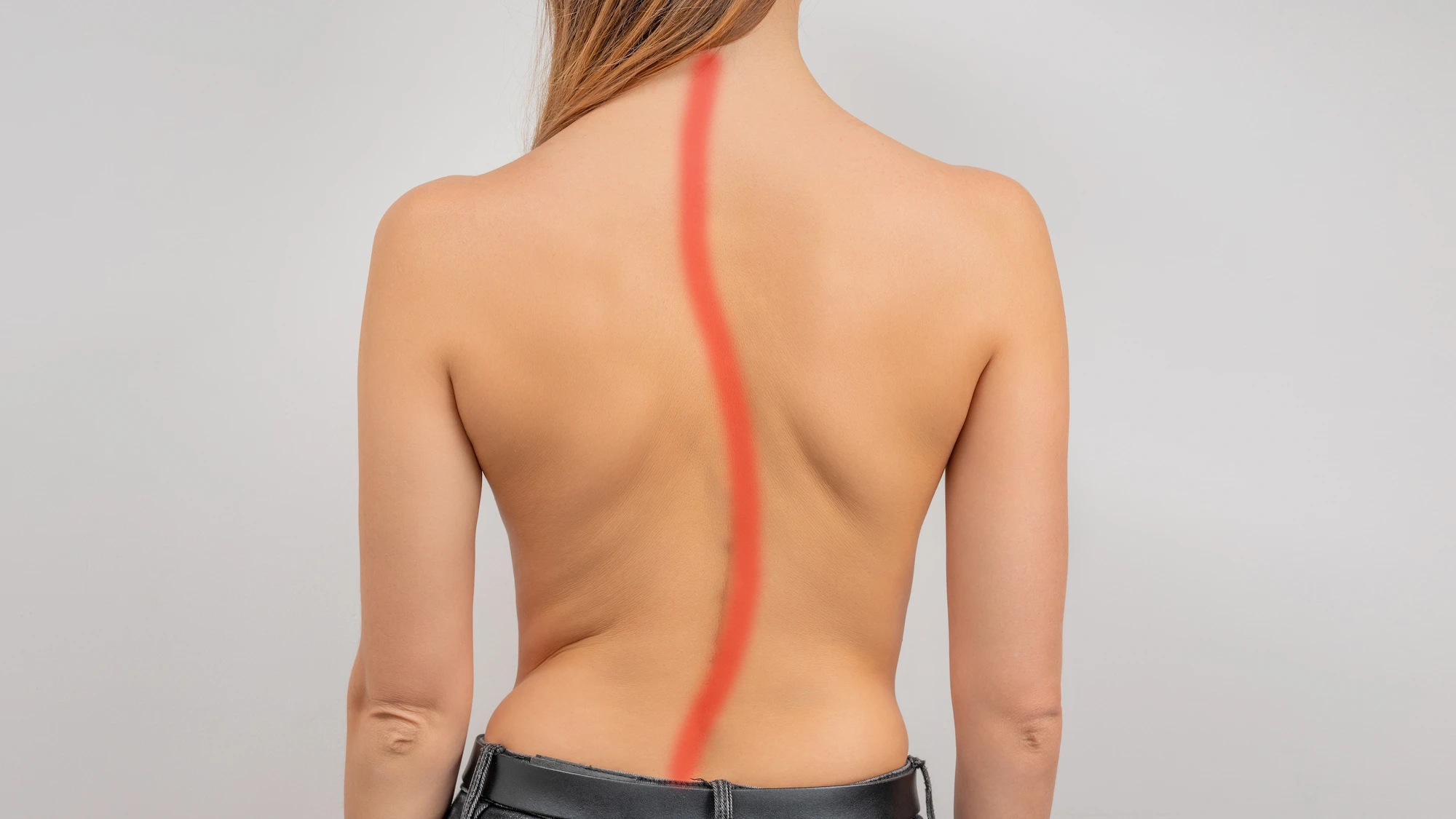 Scoliosis Treatment in Noida